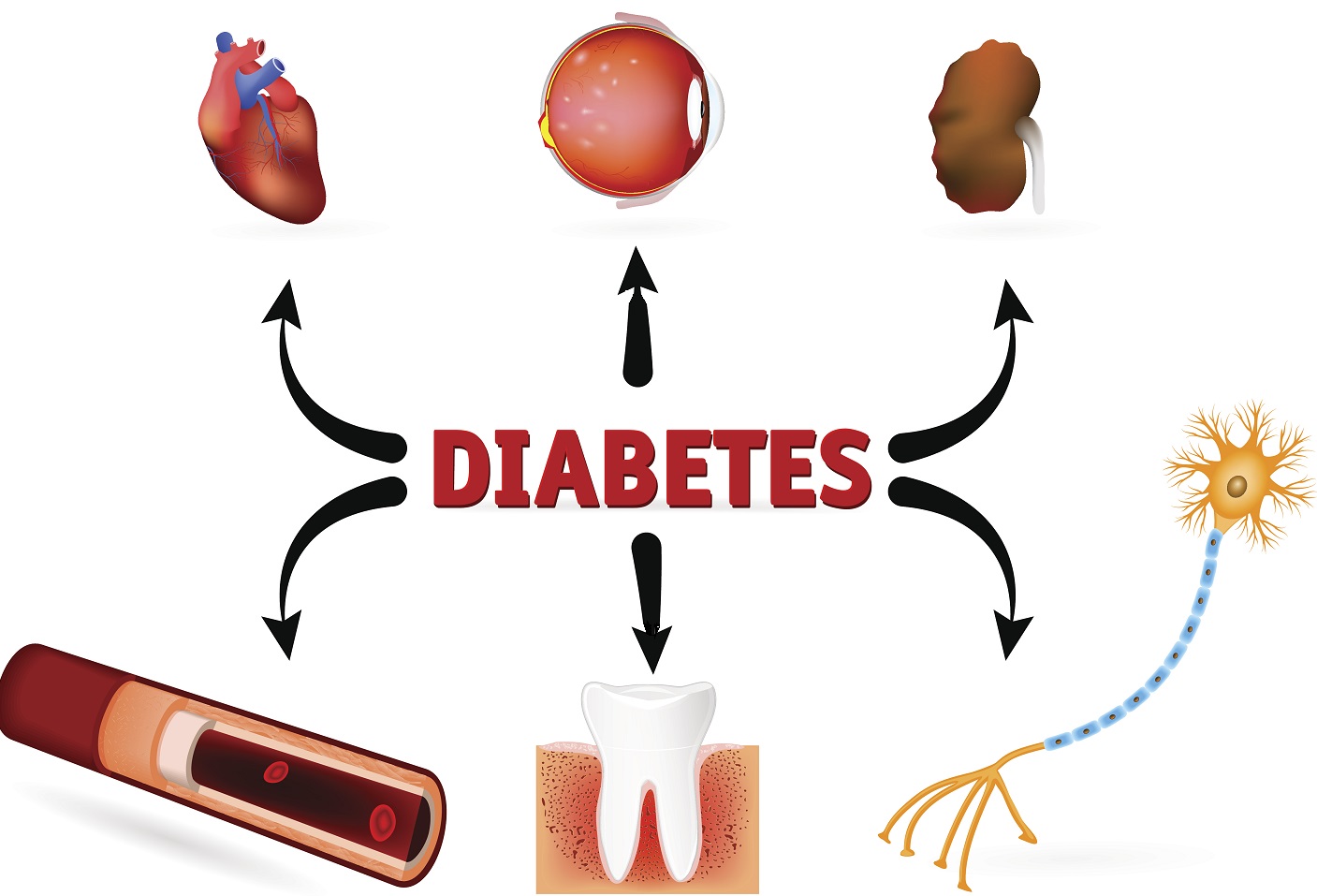 Diabetesforbundet.Web.Features2020.Editorial.Blocks.ImageBlock_DynamicProxy?.AltText